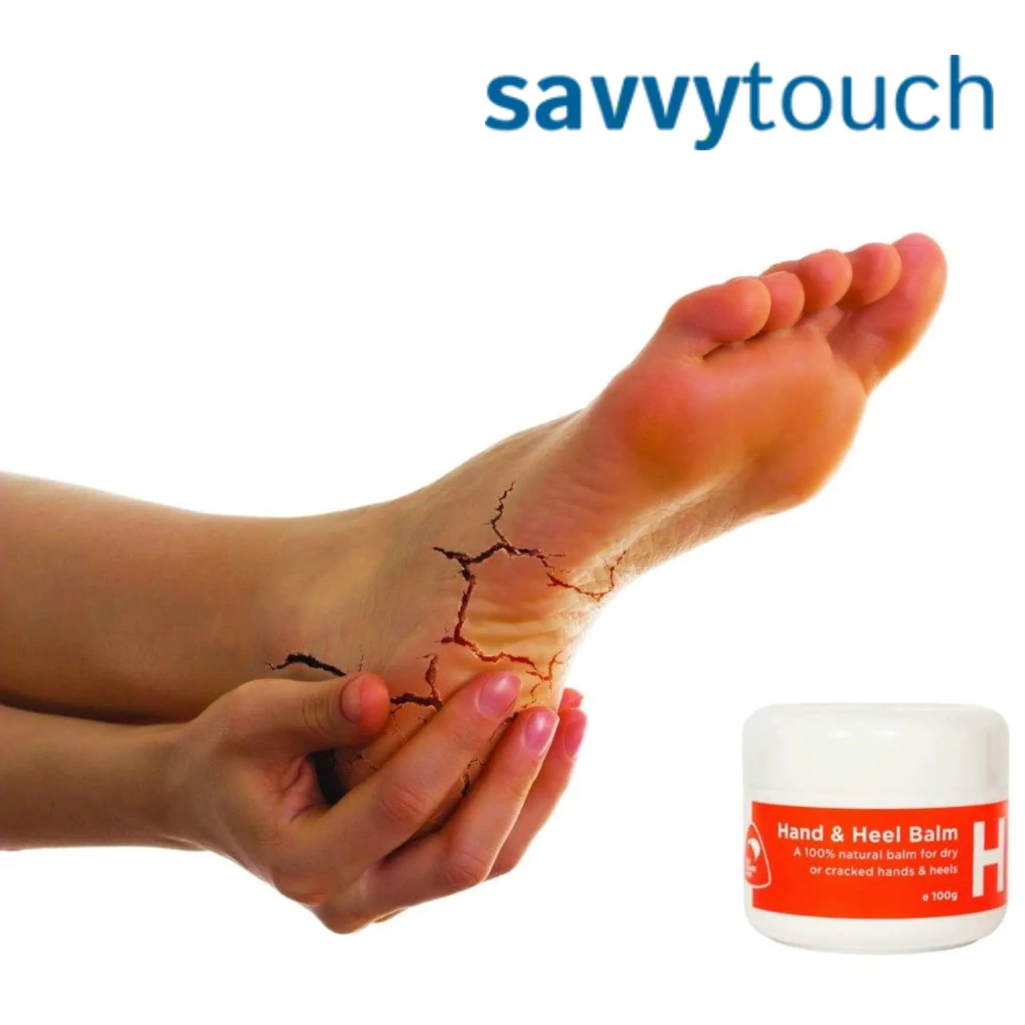 100ml Hand Heel and Foot Cream Balm for Dry Cracked Skin Treatment & Repair: 100% Natural Ingredients for Protection & Healing