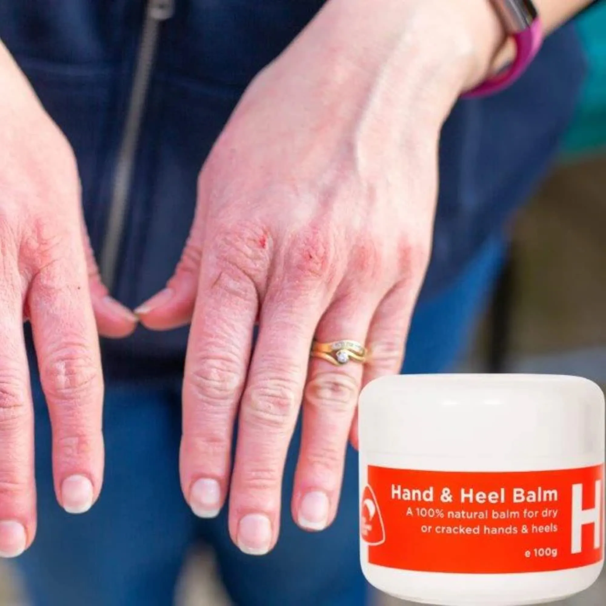 100ml Hand Heel and Foot Cream Balm for Dry Cracked Skin Treatment & Repair: 100% Natural Ingredients for Protection & Healing