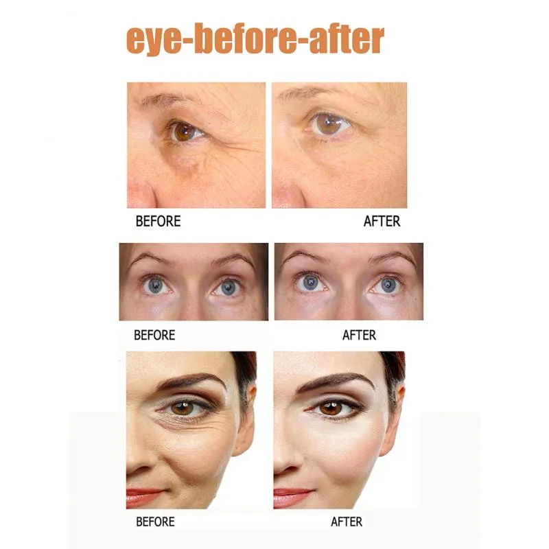 1Pc Instant Eye Bag Removal Cream Long Lasting