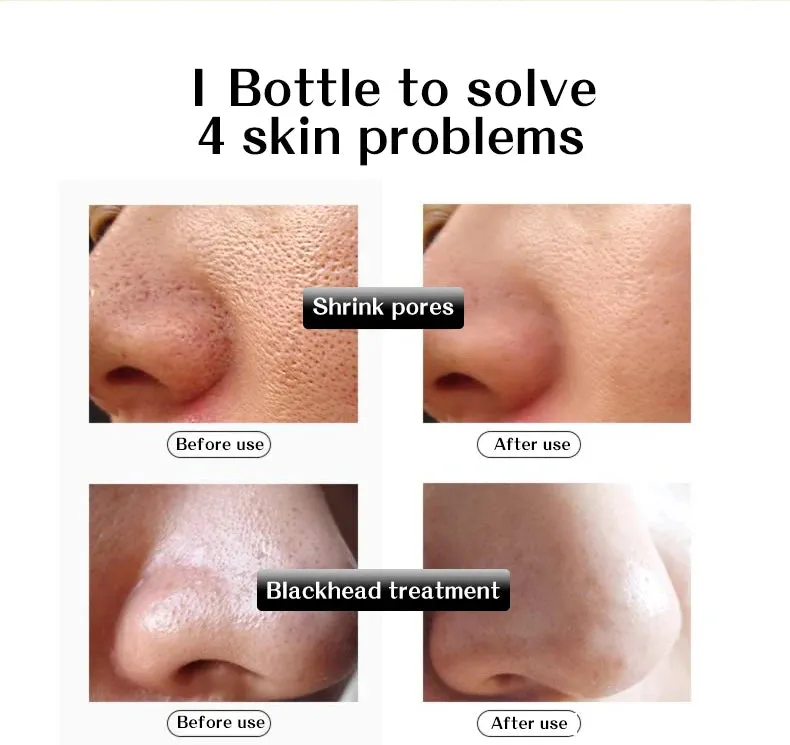 7 Ampoule Hyaluronic Acid  Concentrate Serum