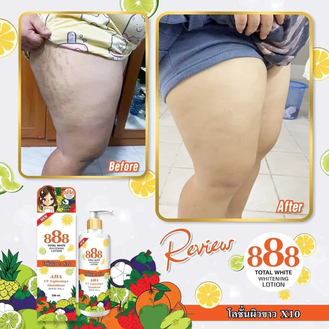888 Total White Whitening Lotion SPF 35