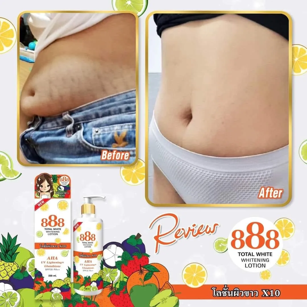 888 Total White Whitening Lotion SPF 35