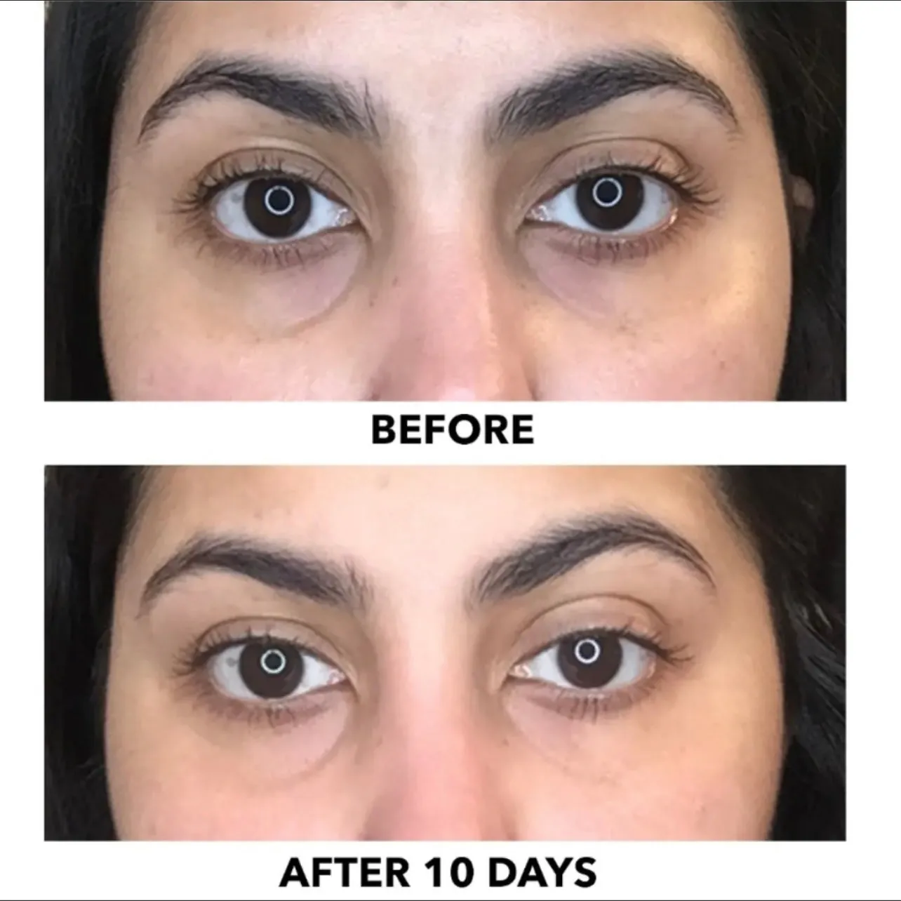 Algenist Triple Algae Eye Renewal Balm, Anti aging Vegan Eye Cream, Dark Circle Bag Remover, Standard Size 15ml/.5