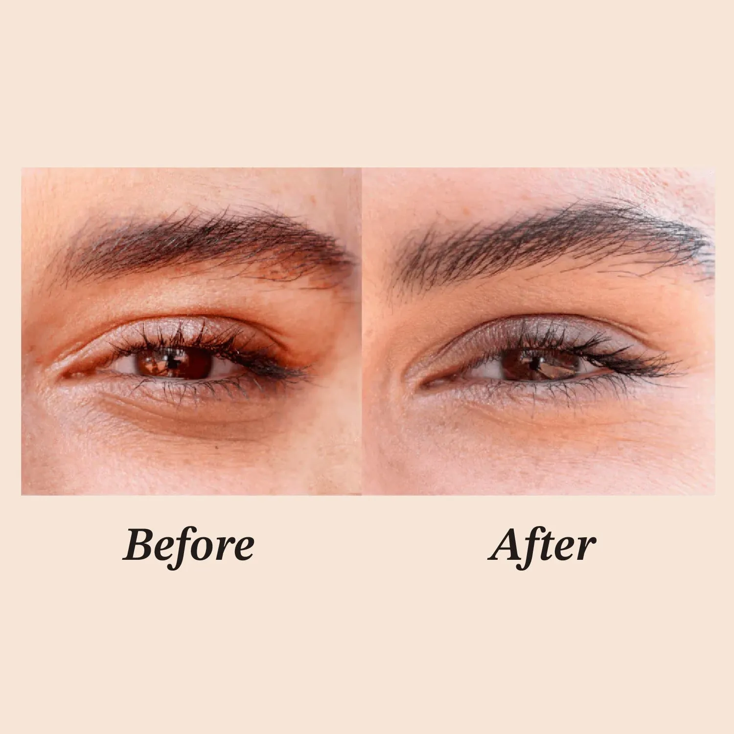 All In Eye Cream