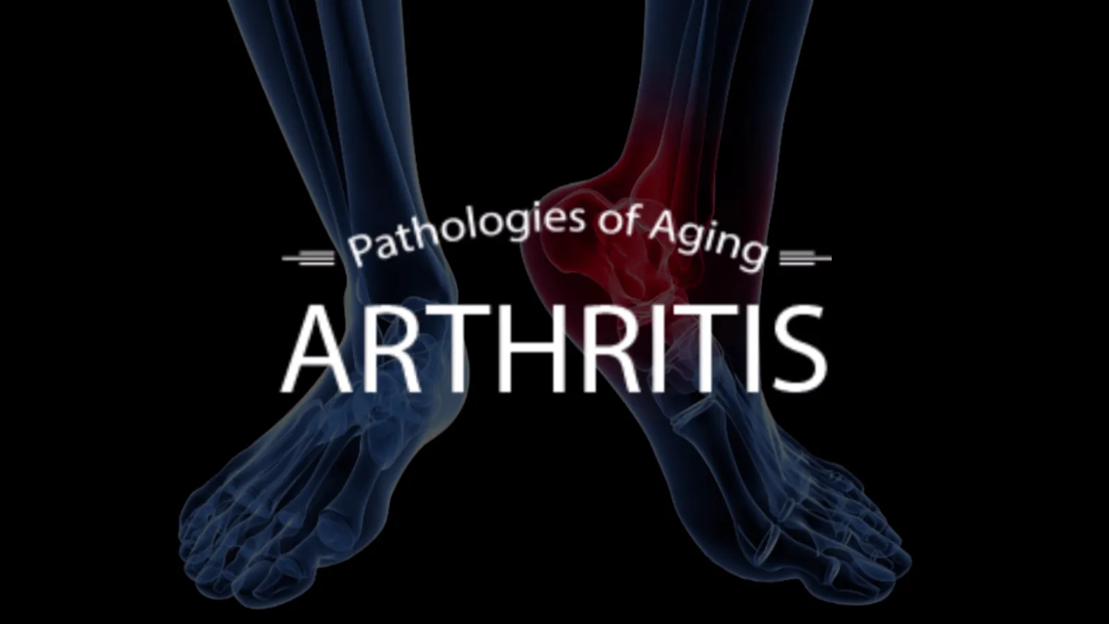 Ayurveda & Anti-Aging (Secrets of Ayurveda and Chinese Medicine - Diet and Herbs for Anti Aging)