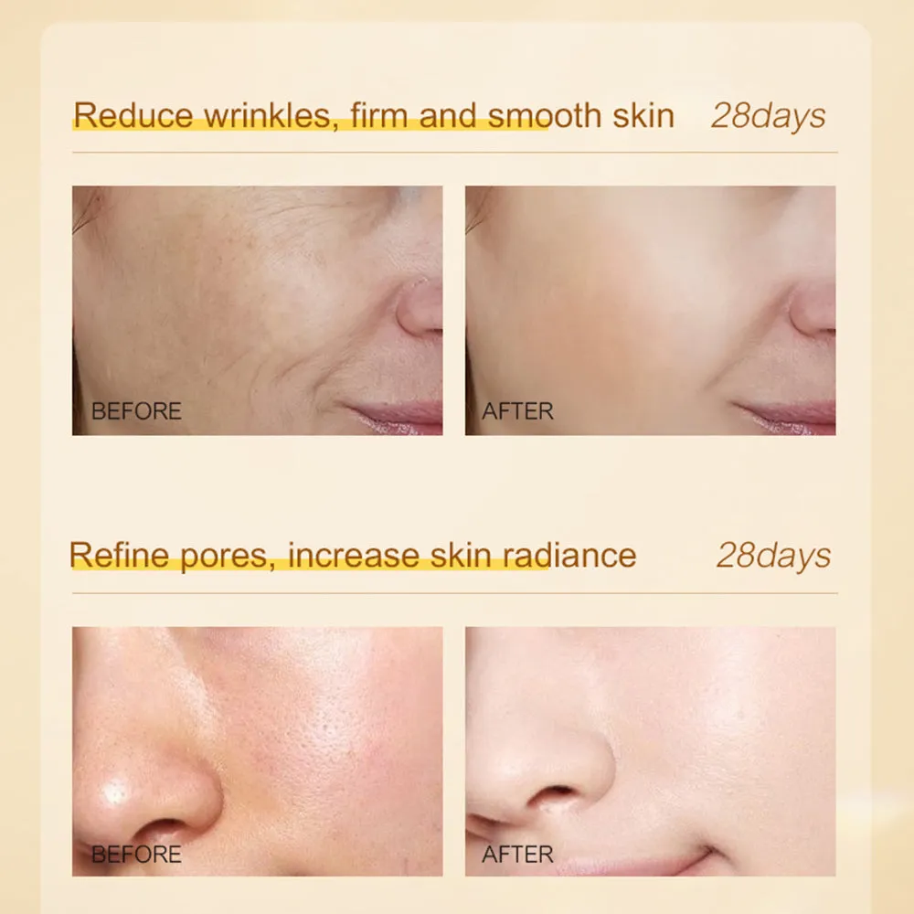 BEKAY - 7Pcs/set Fullerene Nicotinamide Skin Care Set