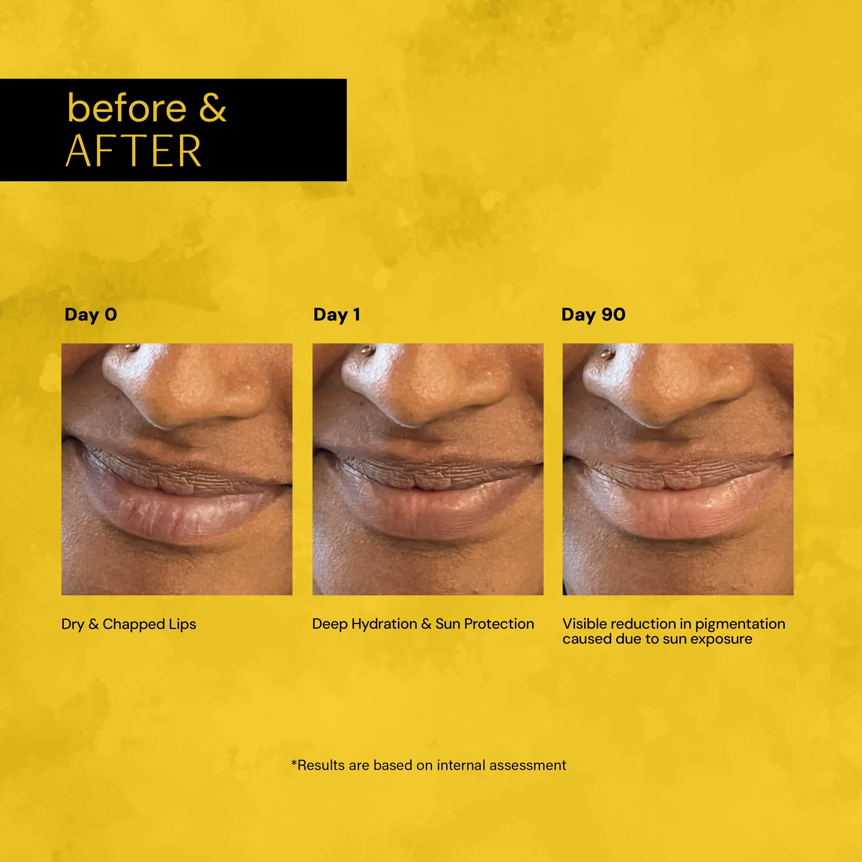 Brightening Lip Balm With SPF Duo - 1% Vitamin C   0.1% Resorcinol