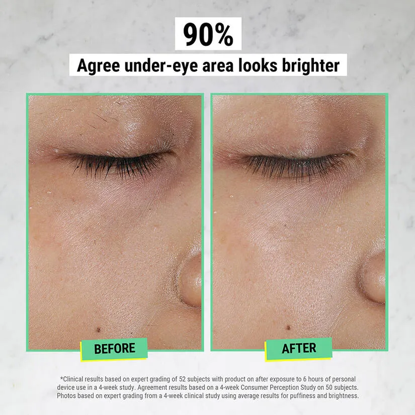 Creamy Eye Treatment with Avocado | kiehl's