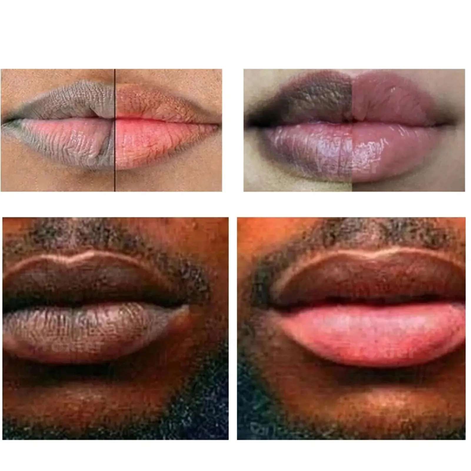 Dark Lip Scrub & Moisturizer for Smokers
