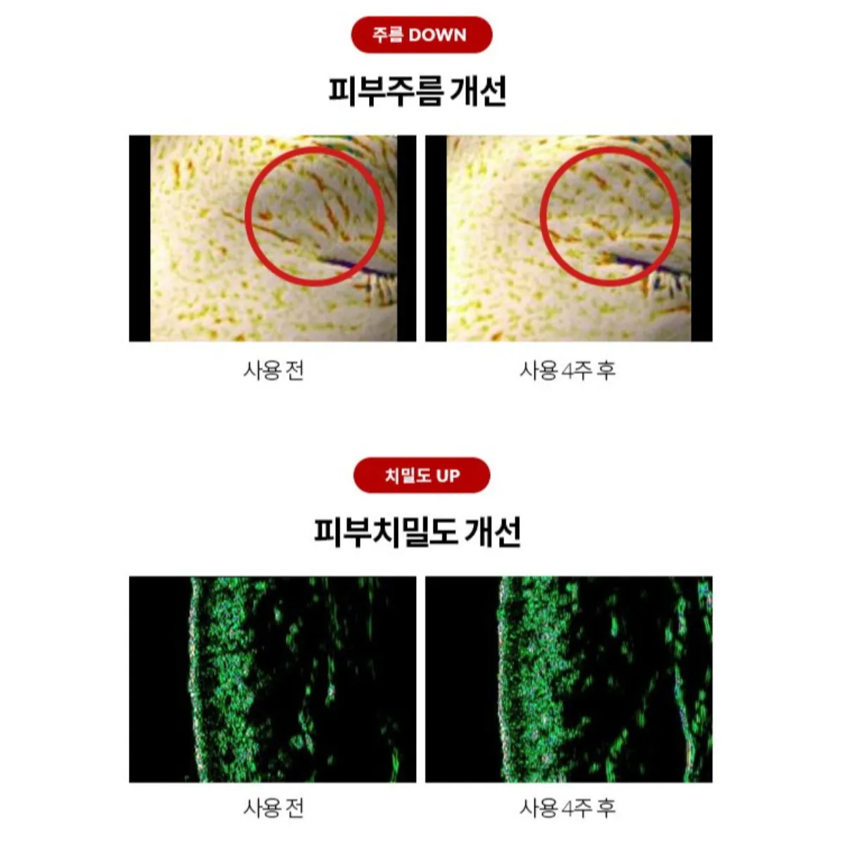 Dr.Different VITALIFT-A Forte 20g Retinal 0.1% Vitamin A Cream (  Free Gift : Barrier Balance Deep Cream 40ml) Anti-aging Wrinkle Care Lifting Moisturizing / from Seoul, Korea