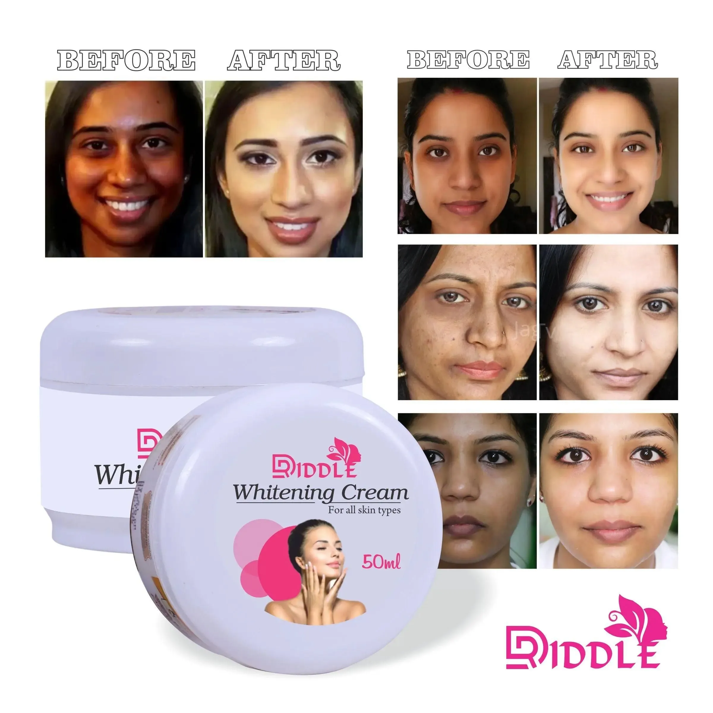 Driddle WhiteGlow Skin Whitening Cream & Brightening Nourishing Cream