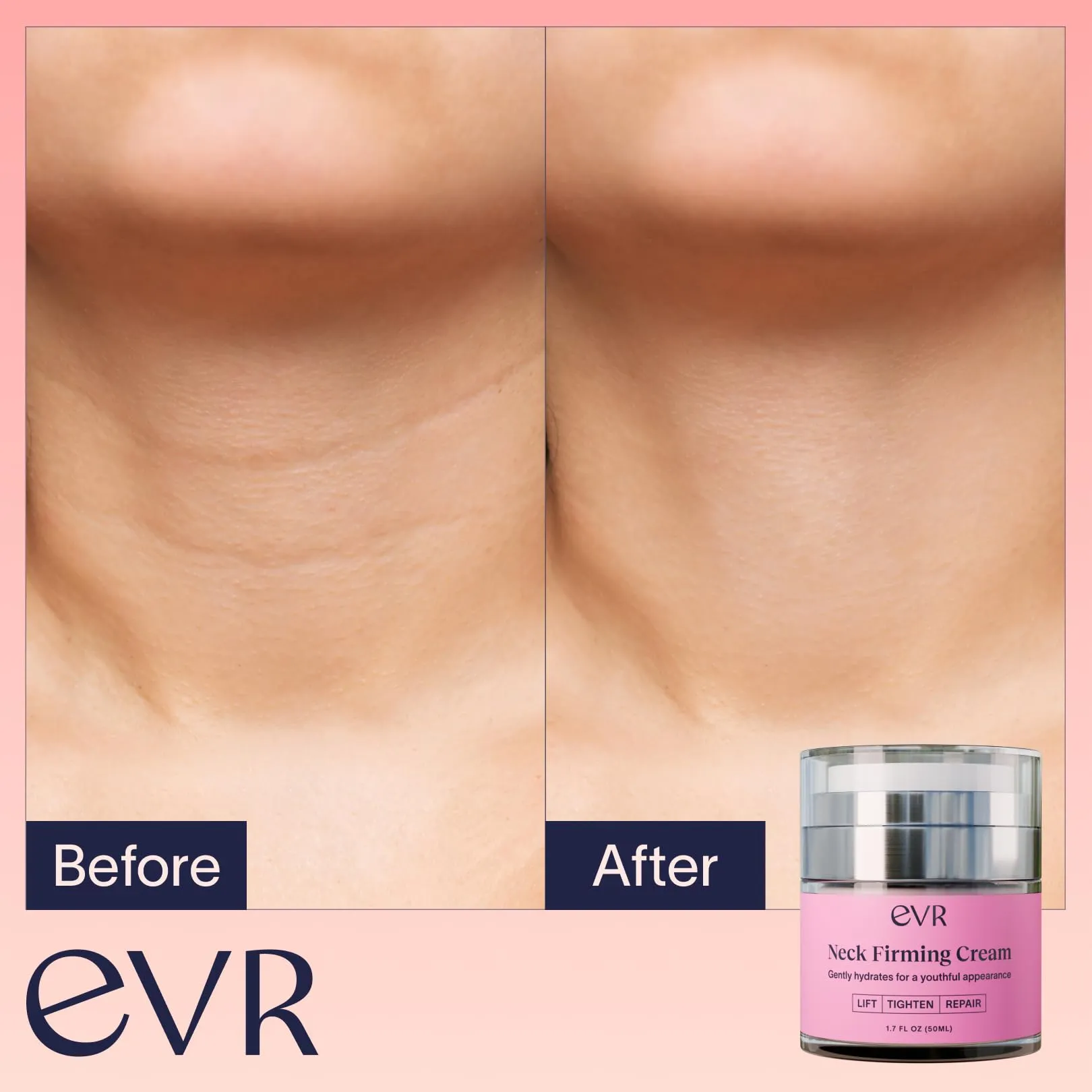 EVR BEAUTY Anti-aging Neck Firming Cream with Collagen & Hyaluronic Acid - Made in USA with Natural & Organic Ingredients Face Neck and Chest Tightening Moisturizer (Classic)