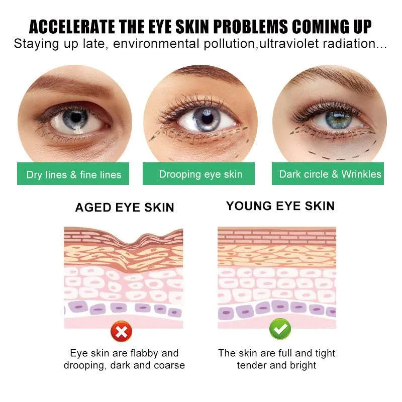 Eye Cream for Dark Circles and Puffiness, Bags Under Eyes Treatment, Anti-Aging Collagen Eye Cream for Wrinkles, Day & Night Caffeine Eye Cream with Niacinamide Dimethicone