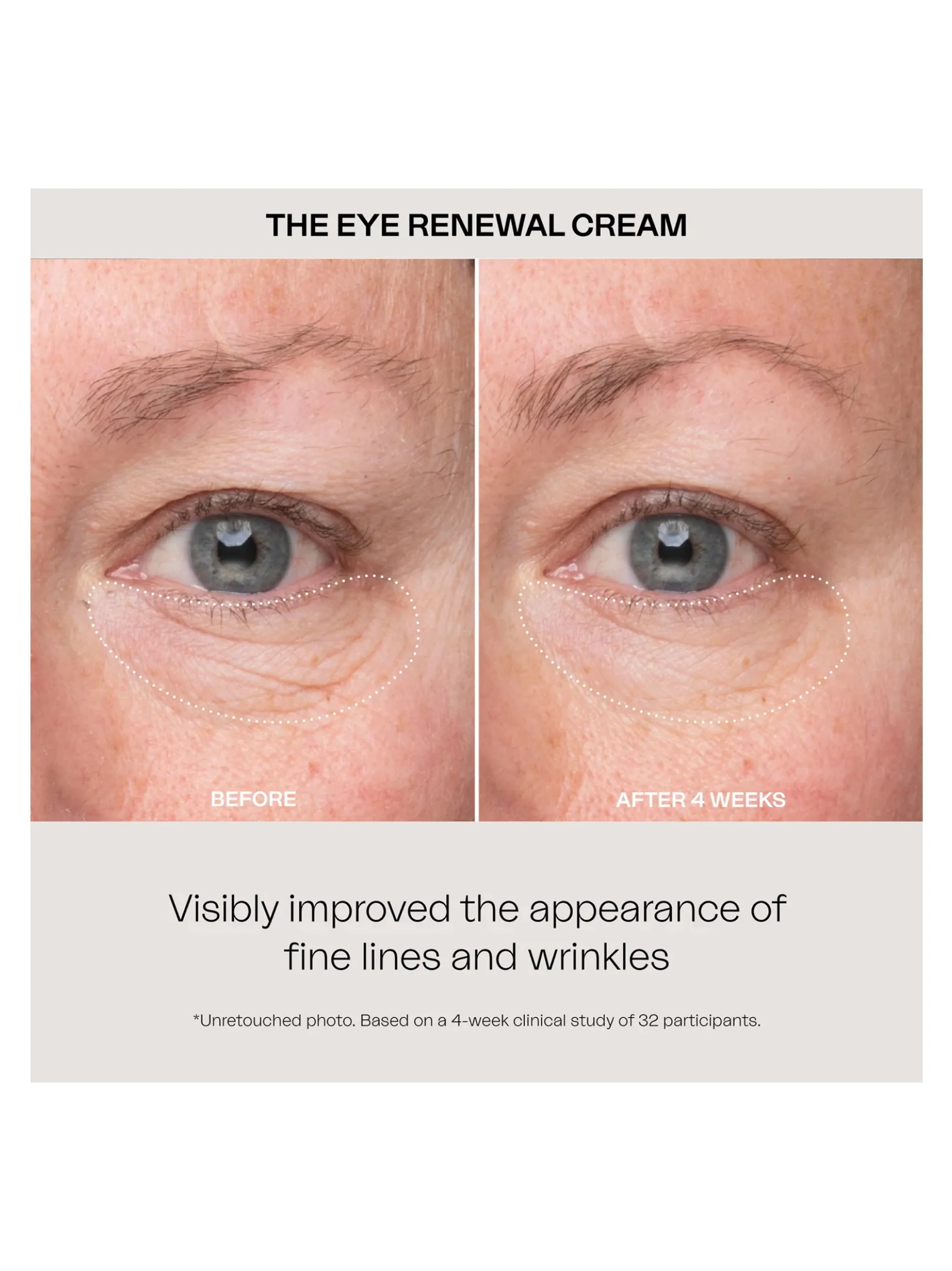 Eye Renewal Cream