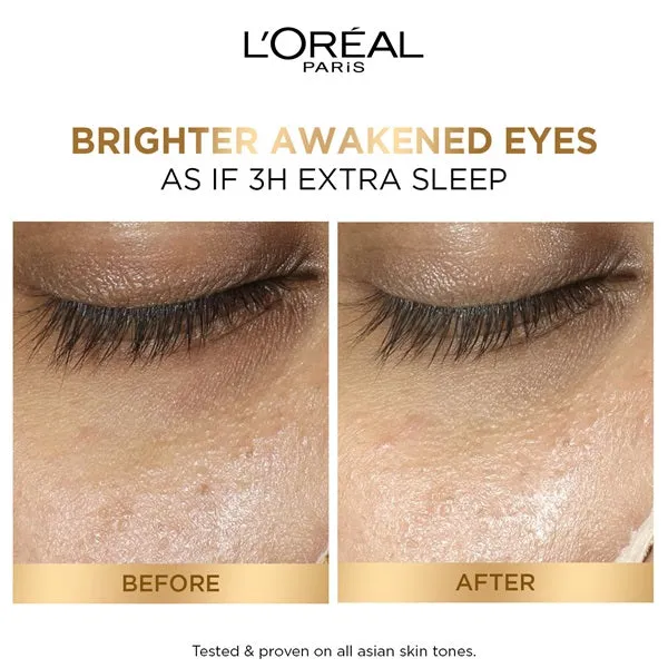 Glycolic [3% Glycolic Acid    Vitamin CG   Niacinamide] Eye Serum For Dark Circles, Brighten Eyes 20