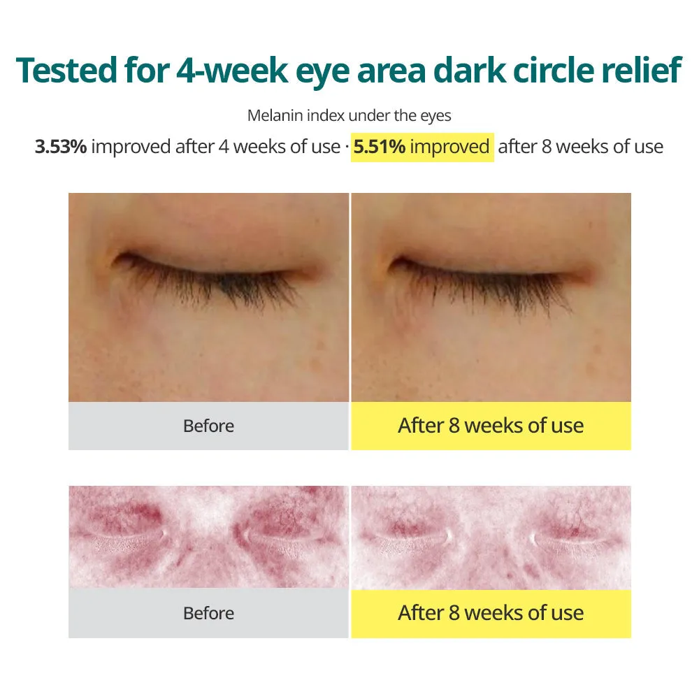 Green Tangerine Vita C Dark Circle Eye Cream [Renewal] 30ml