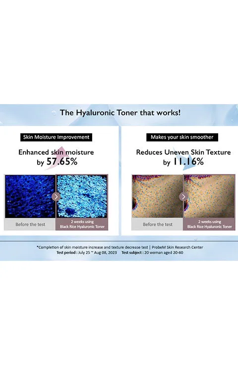 Haruharu Wonder Black Rice Hyaluronic Toner for Sensitive Skin