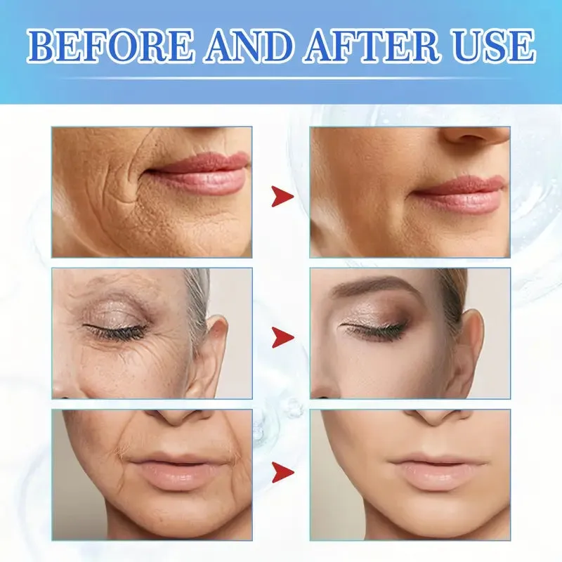 Intensive Anti Aging Botox Facial Serum - Collagen Serum For Skin With Vitamin C, Hyaluronic Acid and Niacinamide
