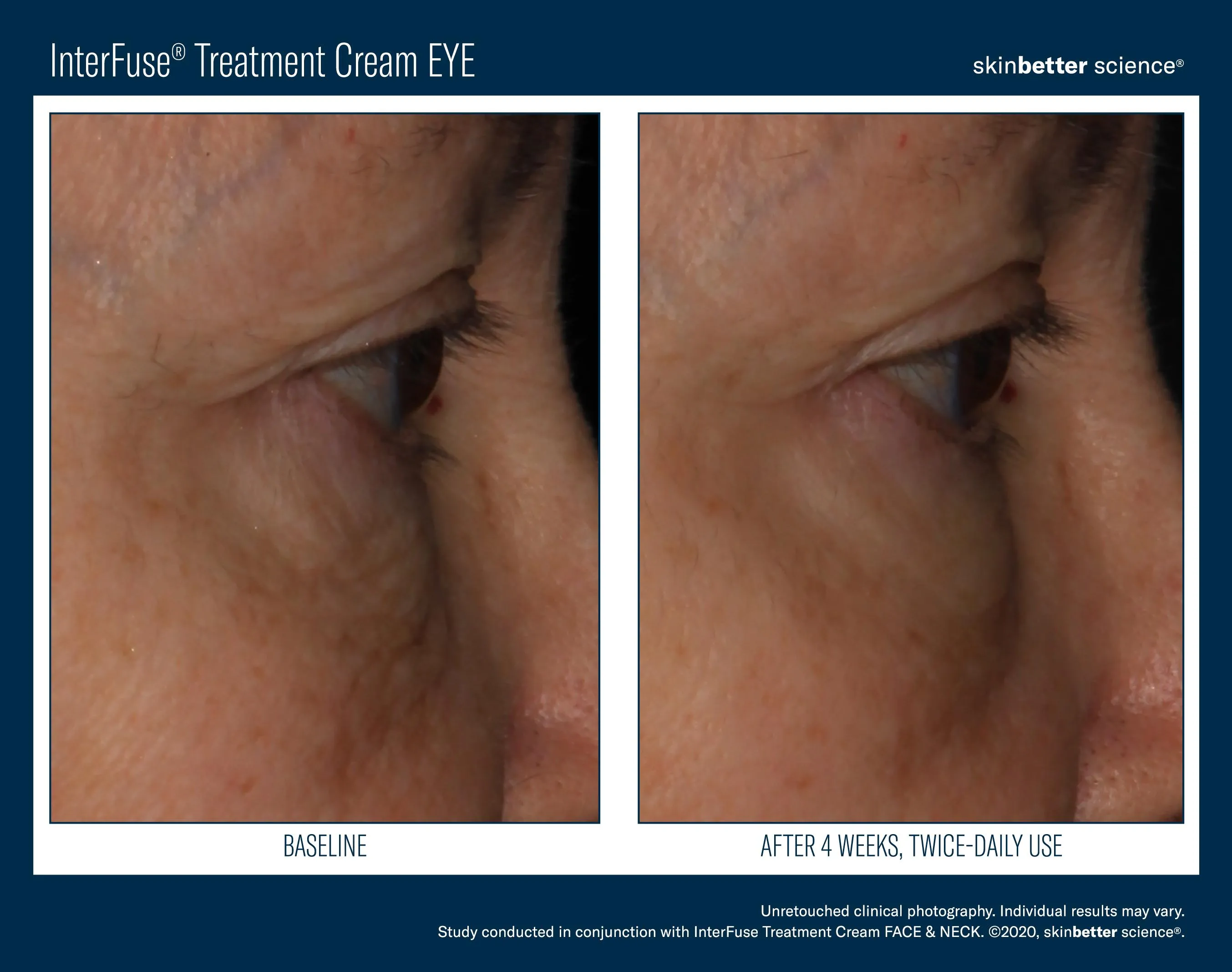 InterFuse Treatment Cream EYE