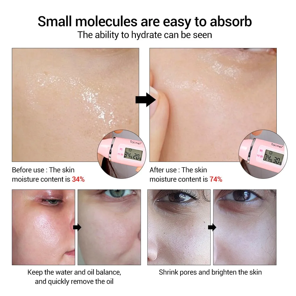 LANBENA Hyaluronic Acid Serum Blackhead Removing Moisturizing Acne Treatment Skin Care Repair Whitening AntiAnging Winkles 15ml