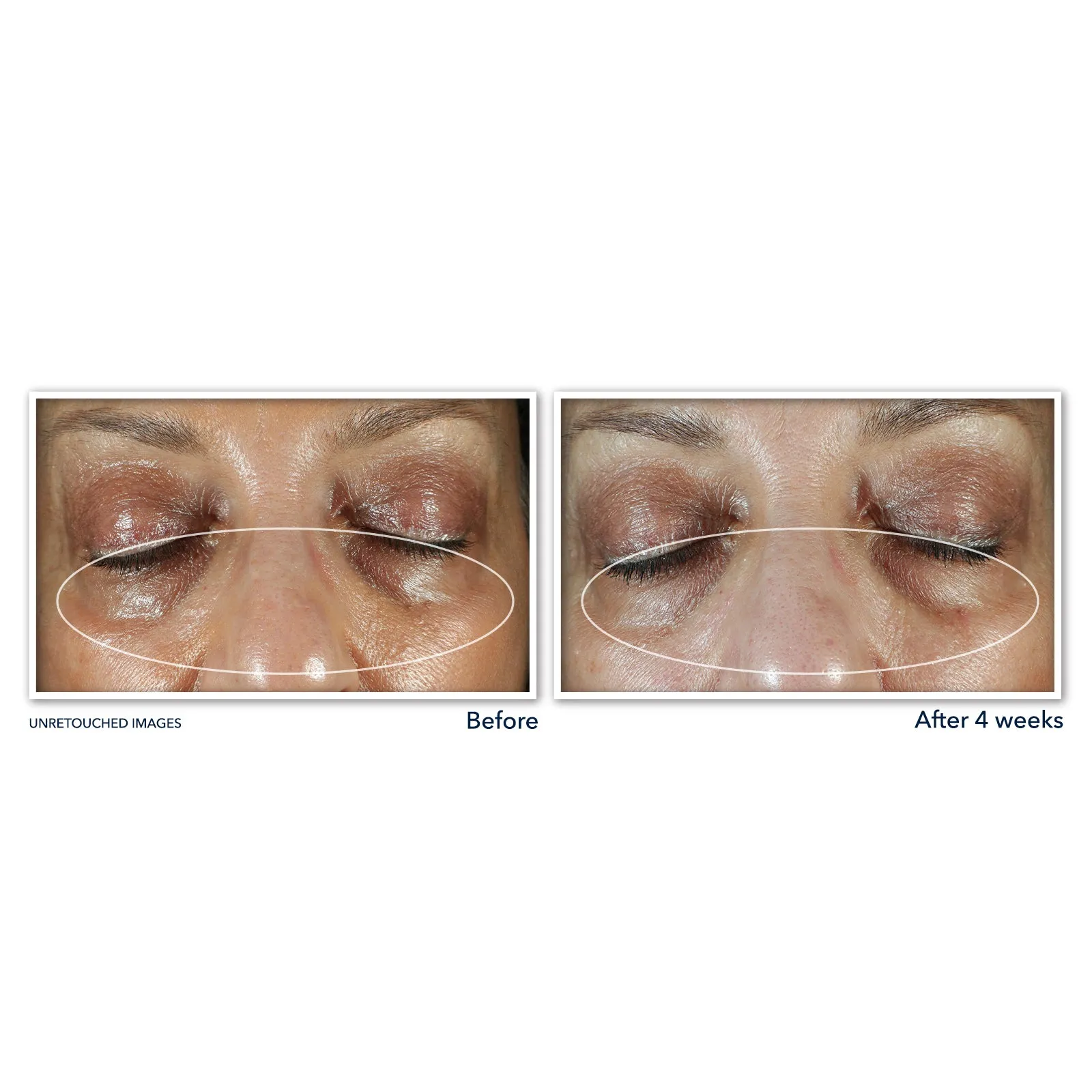 MULTI CORREXION® Even Tone   Lift Eye Cream