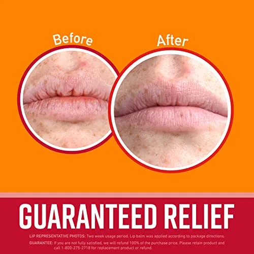 O'Keeffe's Ultra Hydrating Cherry Lip Repair Lip Balm, Relieves Extremely Dry Cracked Lips, All Day Moisture, Stick, (Pack of 1), 109542