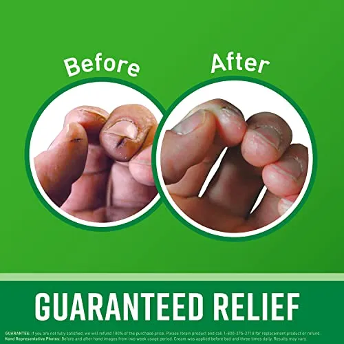 O'Keeffe's Working Hands Hand Cream, Heals, Relieves and Repairs Extremely Dry, Cracked Hands, Boosts Moisture Levels, Value Jar 6.8oz/192g, (Pack of 1) K1680004