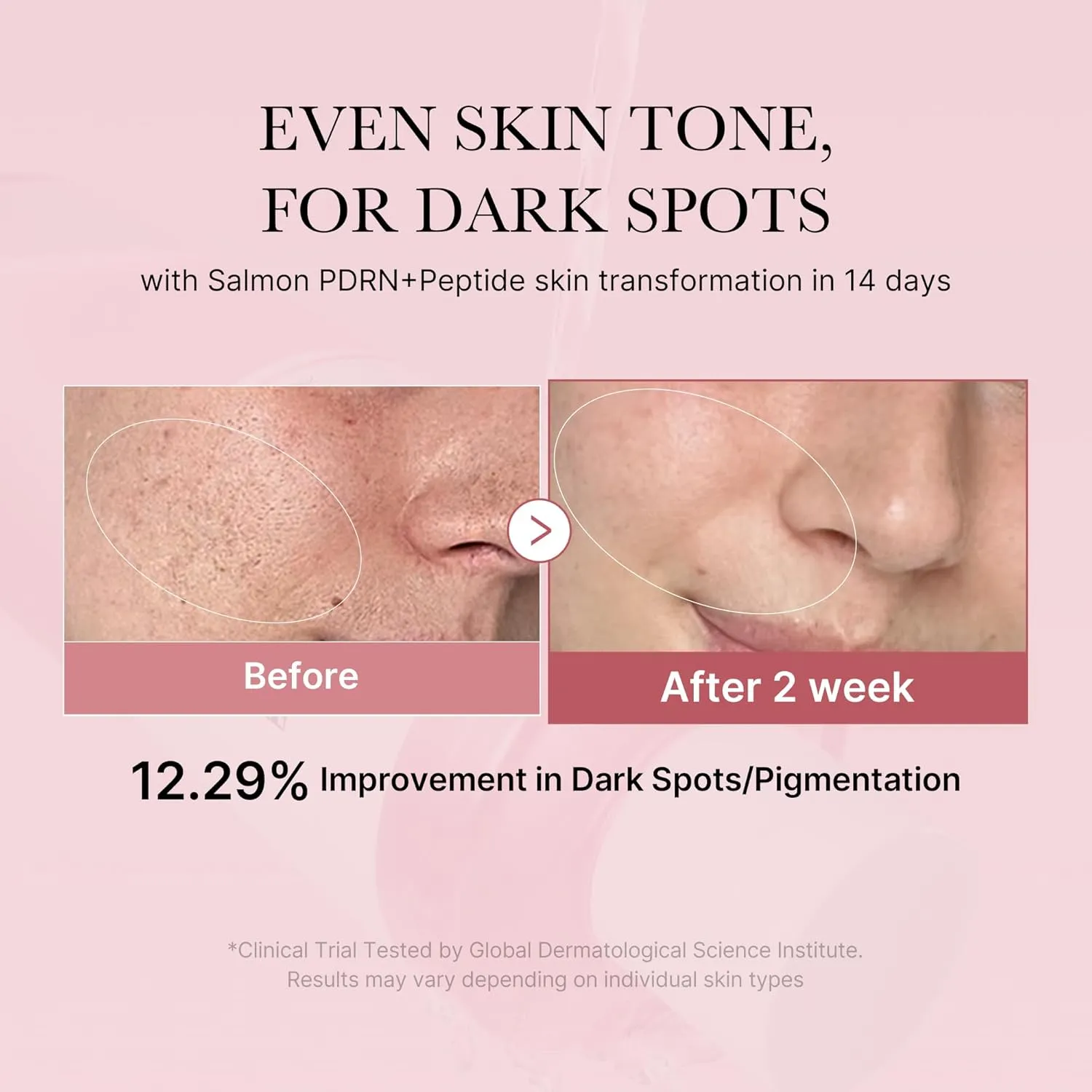 PDRN Pink Cica Soothing Toner