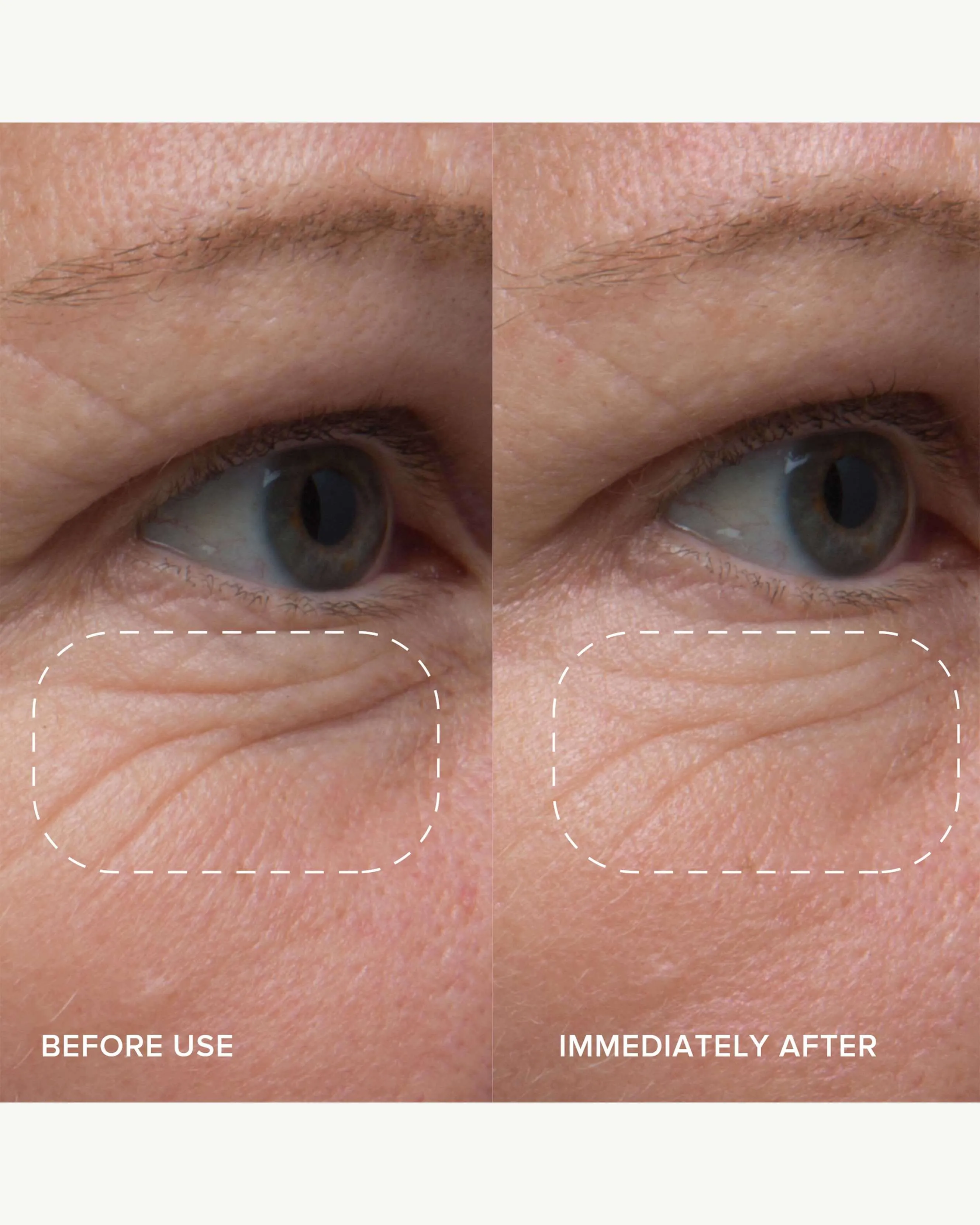 PlantGenius Line-Filling Eye Balm with Bakuchiol