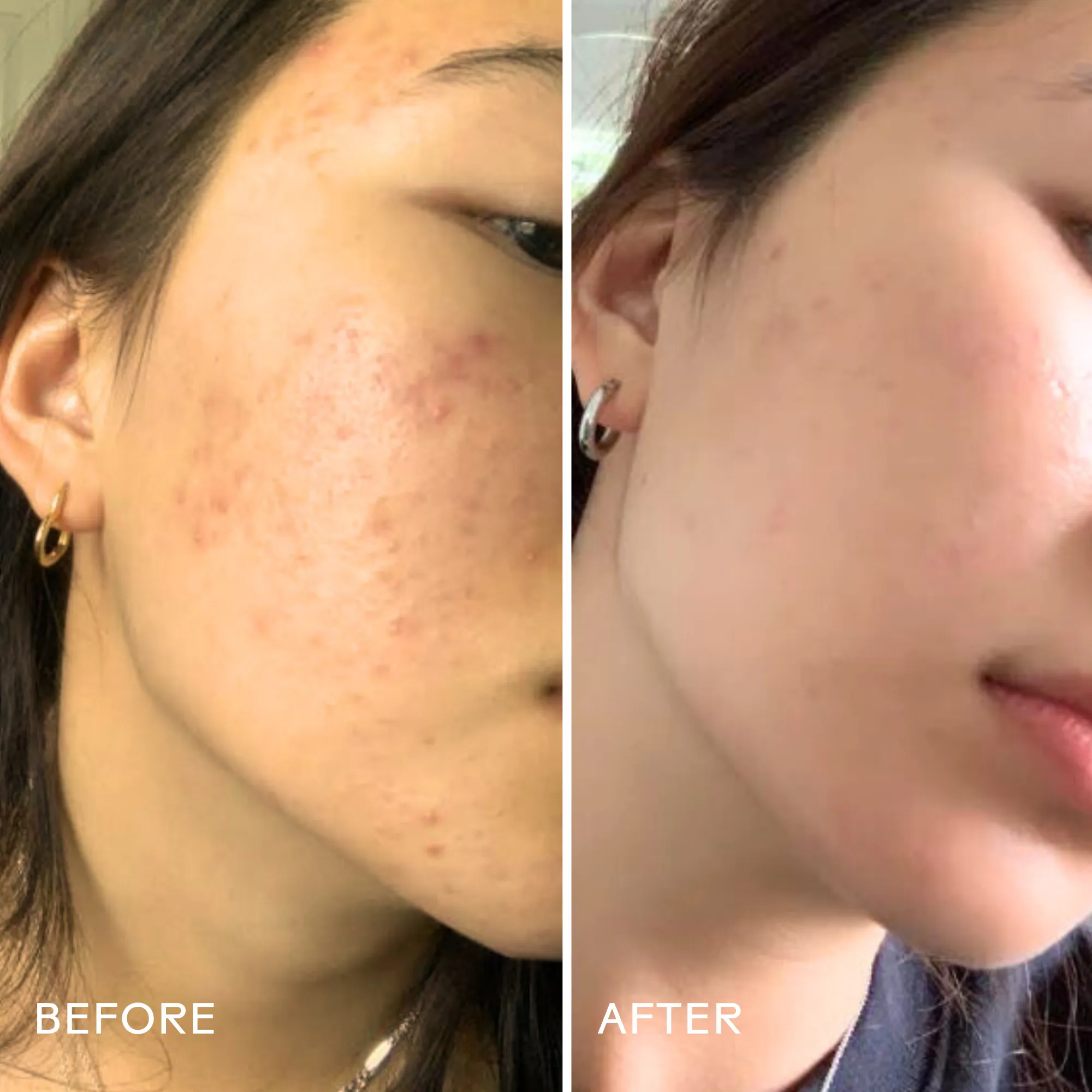 Purify Aloe   Amino Acid Cleanser