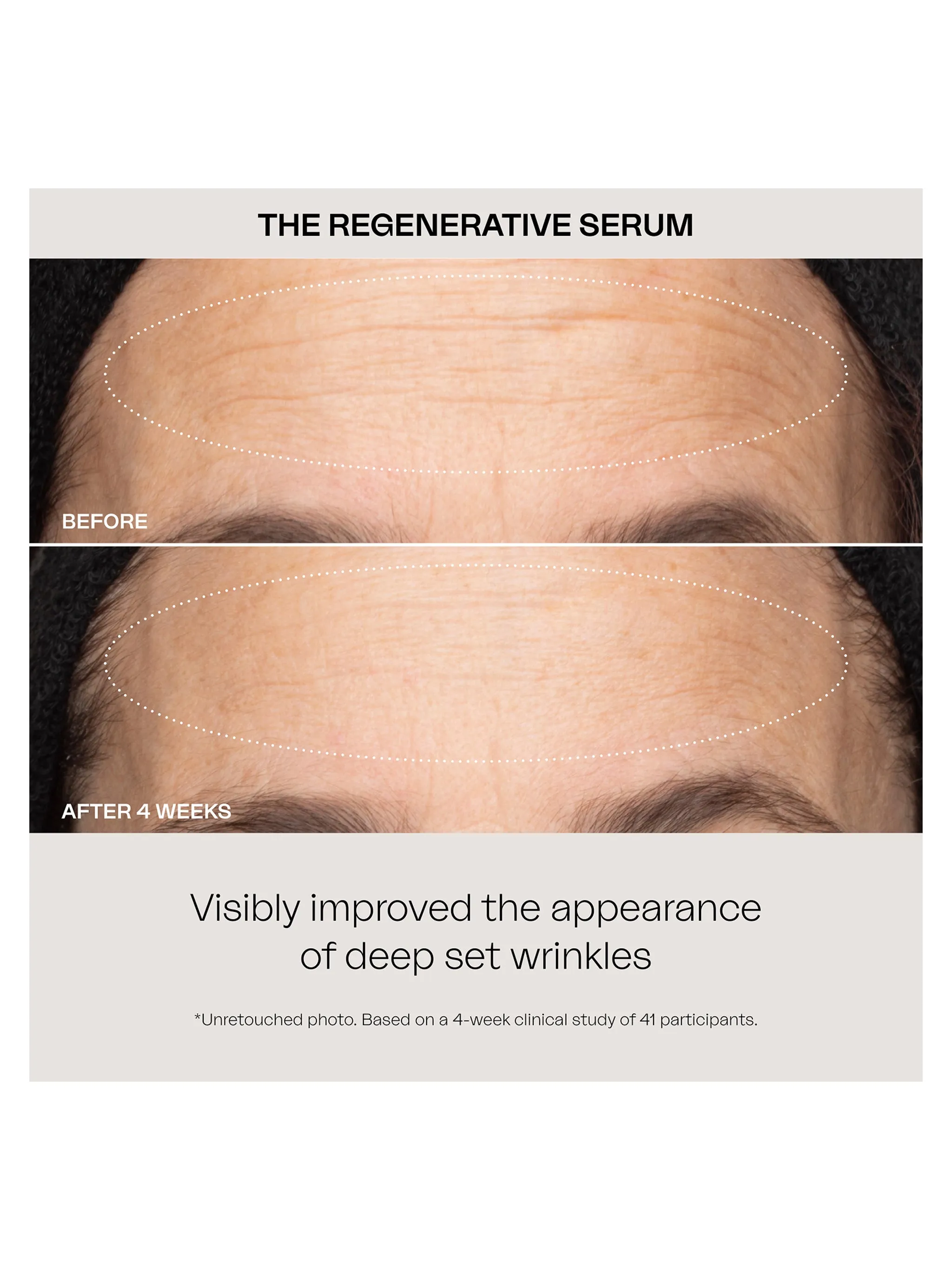 Regenerative Serum