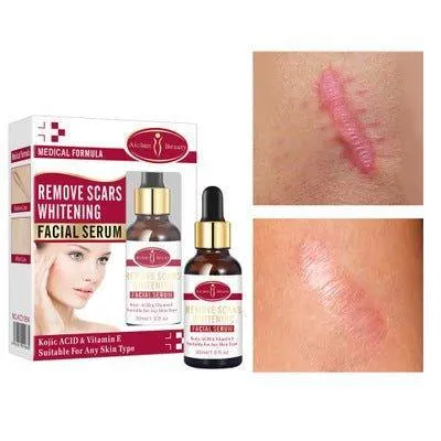 Remove Scars Whitening Facial Serum 30ml - Aichun Beauty