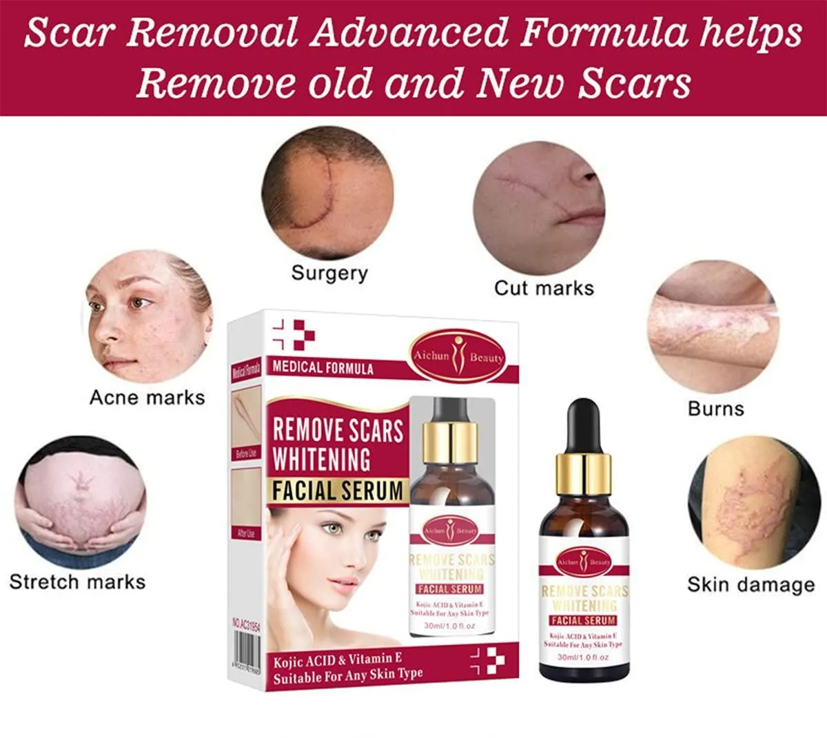 Remove Scars Whitening Facial Serum 30ml - Aichun Beauty