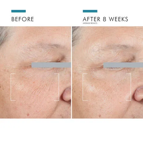 Skinceuticals A.G.E. Advanced Eye 15 ml