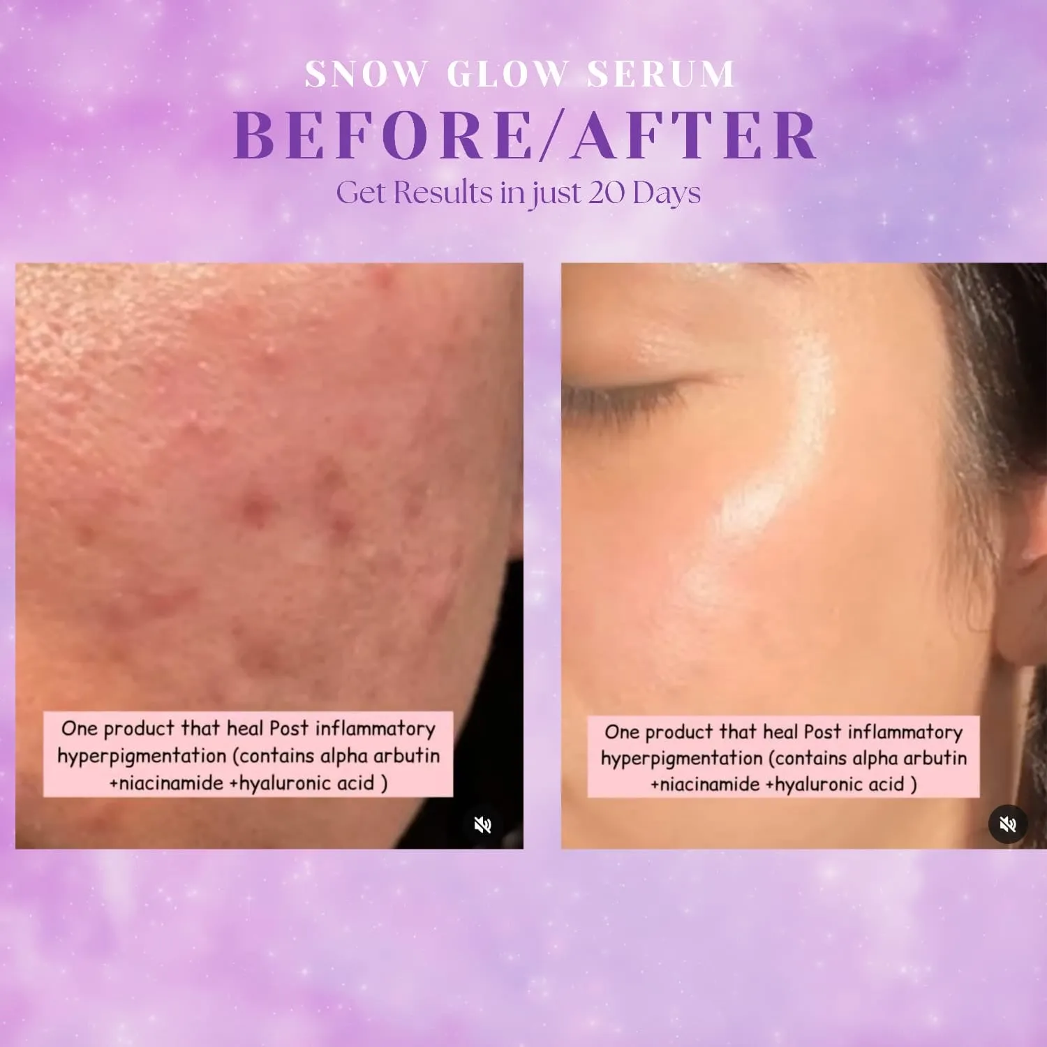 Snow Glow Whitening Serum
