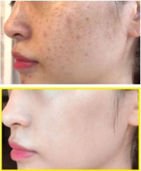 SOMEBYMI Yuja Niacin Brightening Starter Kit