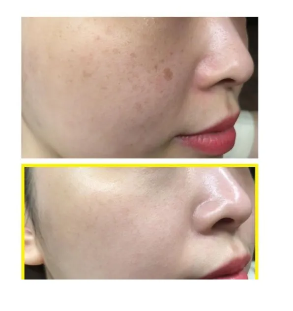 SOMEBYMI Yuja Niacin Brightening Toner