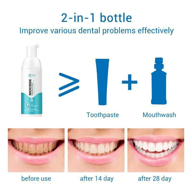 Teeth Whitening Mousse Tooth Whitening Oral Hygiene Foam