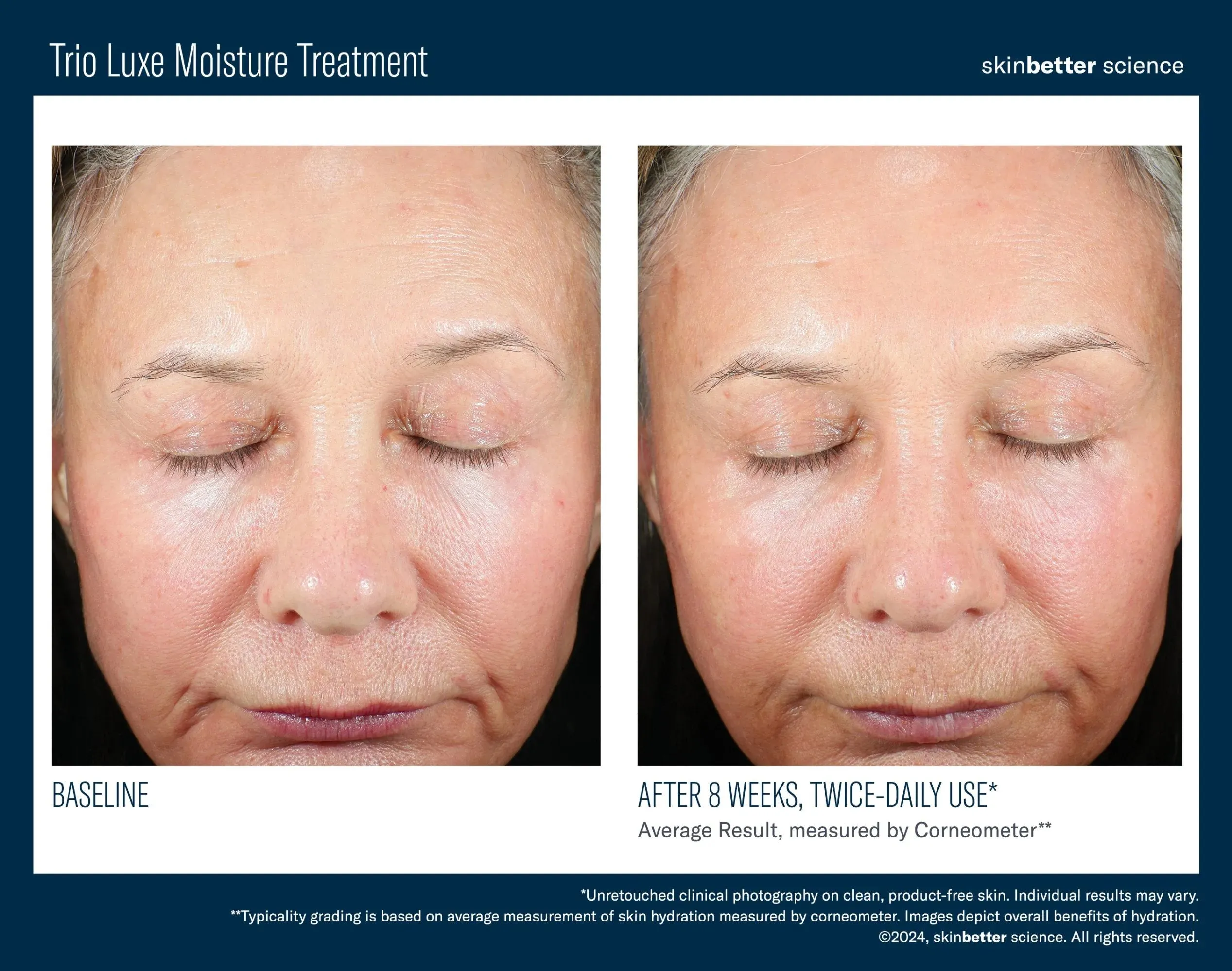 Trio Luxe Moisture Treatment