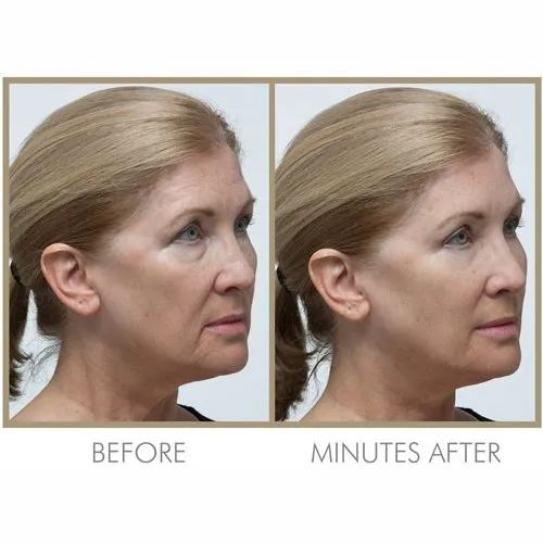 Ultimate Instant Skincare Collection