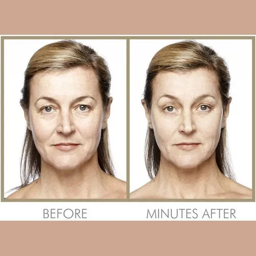 Ultimate Instant Skincare Collection