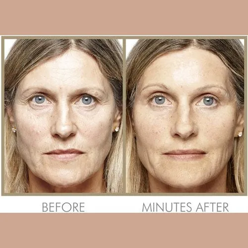 Ultimate Instant Skincare Collection