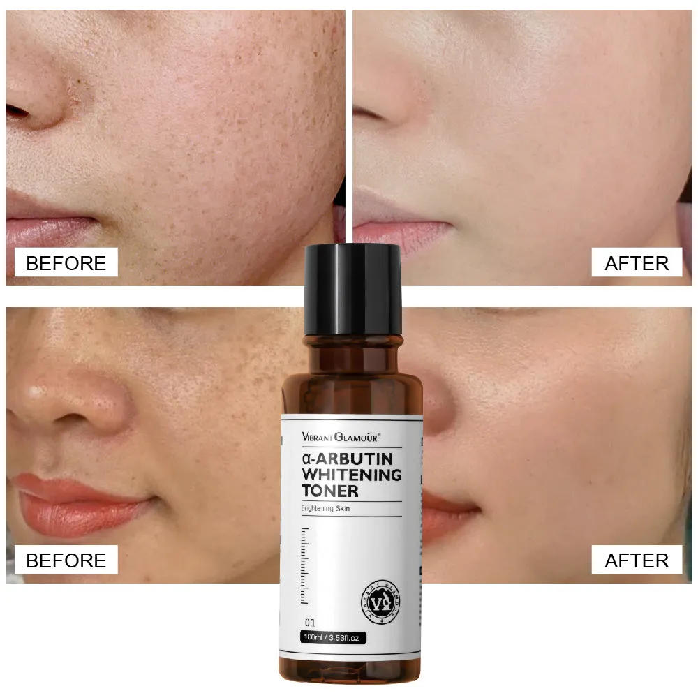 VIBRANT GLAMOUR α-Arbutin Whitening Toner Niacinamide Reduce Dark Spots 100ml